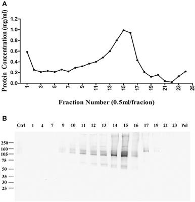 Amyloid Beta Oligomers Target to Extracellular and Intracellular Neuronal Synaptic Proteins in Alzheimer's Disease